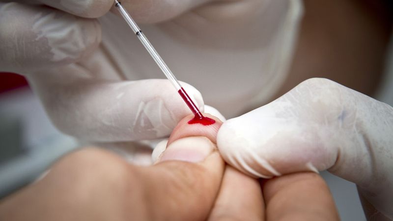 LA DROITE REFUSE LE TEST VIH ANONYME ET GRATUIT !